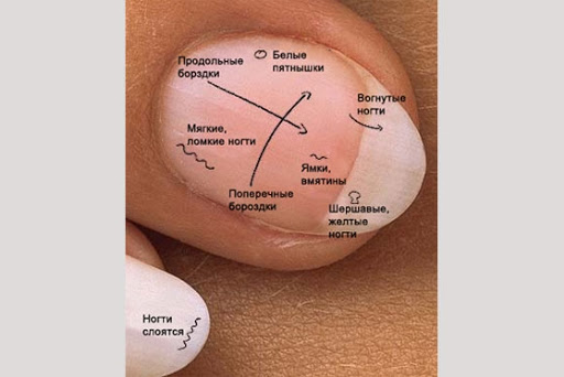 Ногти и здоровье