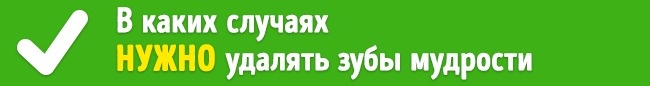 Удалять или нет зубы мудрости